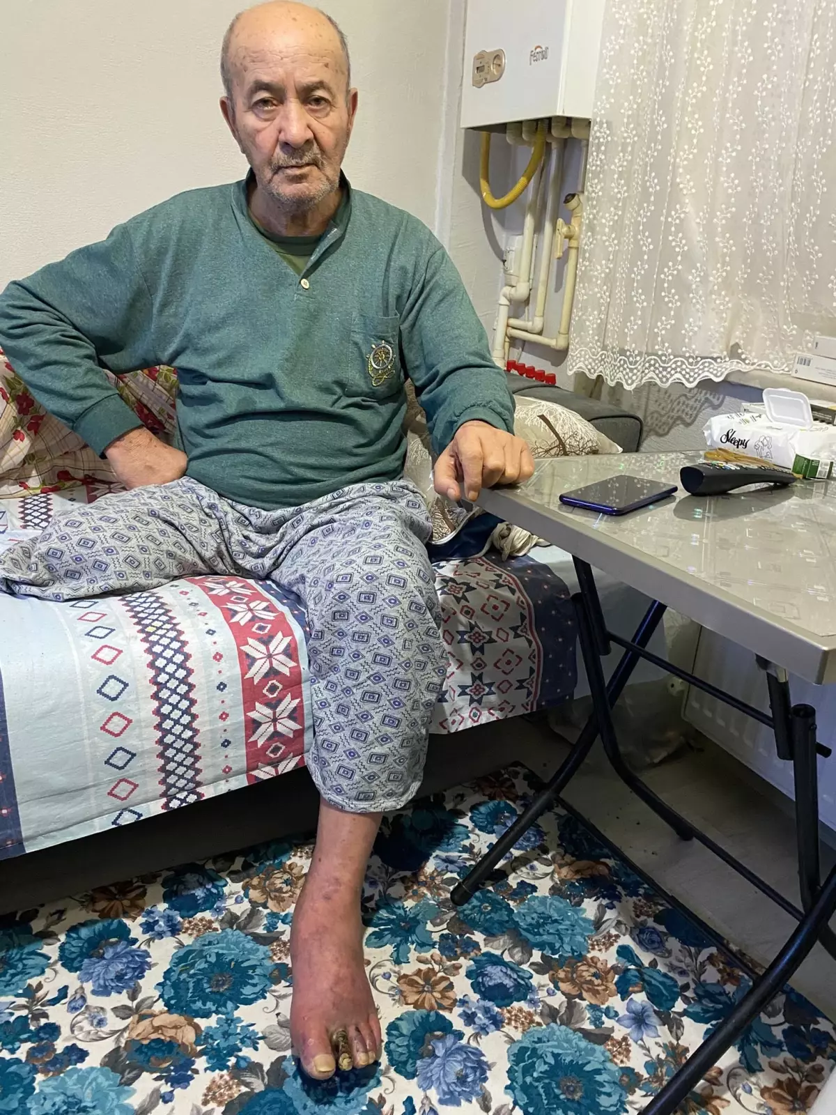 Sağlık Bakanlığı’ndan Kıbrıs Gazisi Sadettin Yıldız’ın Tedavi Sürecine İlişkin Açıklama